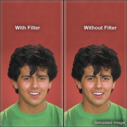 Schneider 5.65 x 5.65" HD Classic Soft 1 Filter