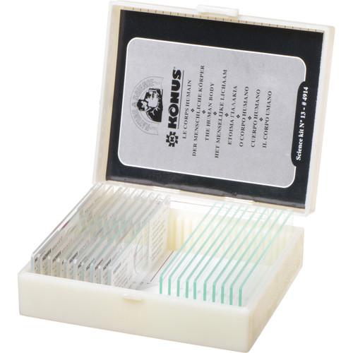 Konus #4914 Biology 2 Slide Set: Human Tissue with Pathology, Part I