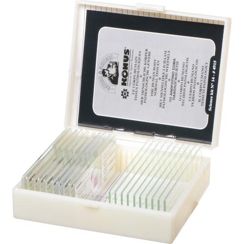 Konus #4915 Biology 2 Slide Set: Human Tissue with Pathology, Part II