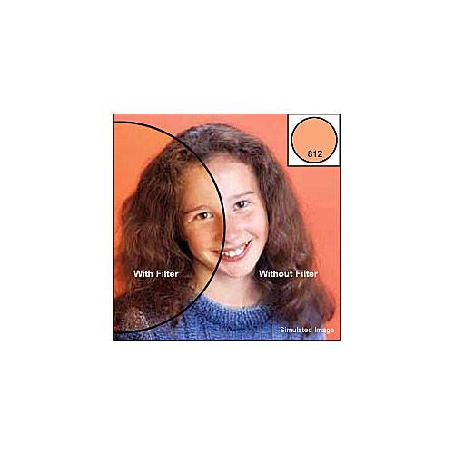 Tiffen 77mm Video Essentials DV Kit 3