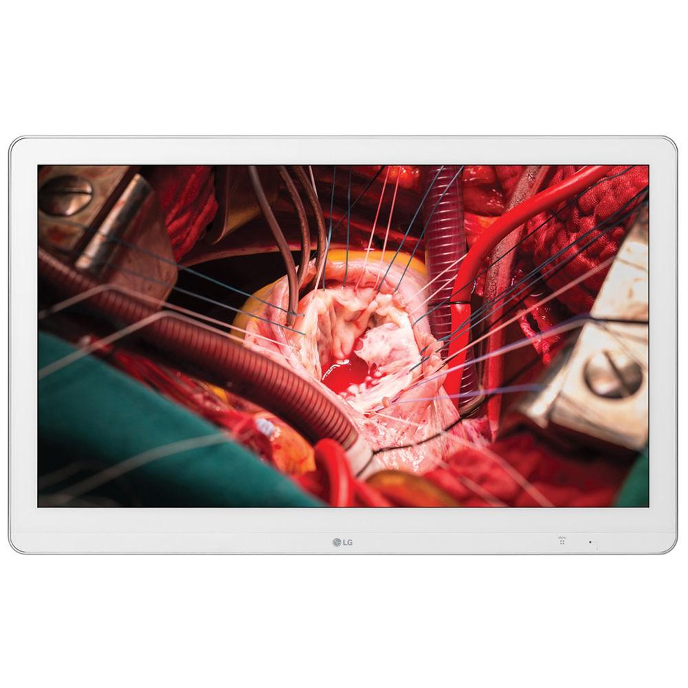 LG 27" 27HK510SW Full HD IPS Surgical Monitor