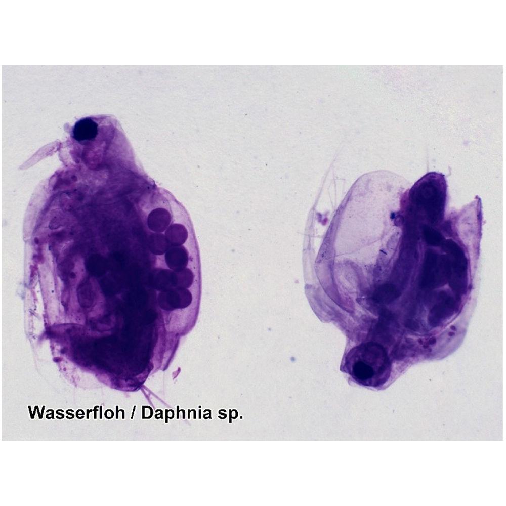 BRESSER Prepared Slides Set