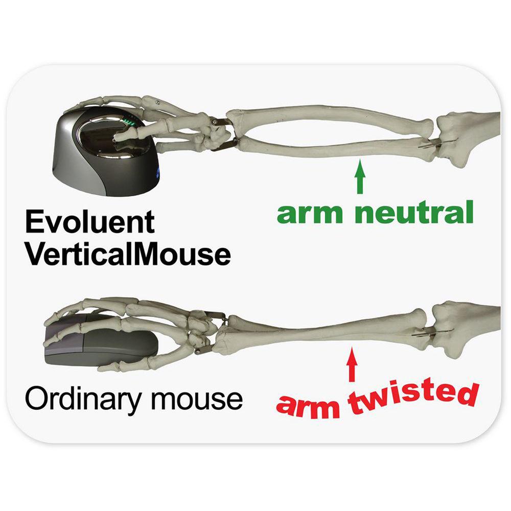 Evoluent VerticalMouse 4 Right Bluetooth