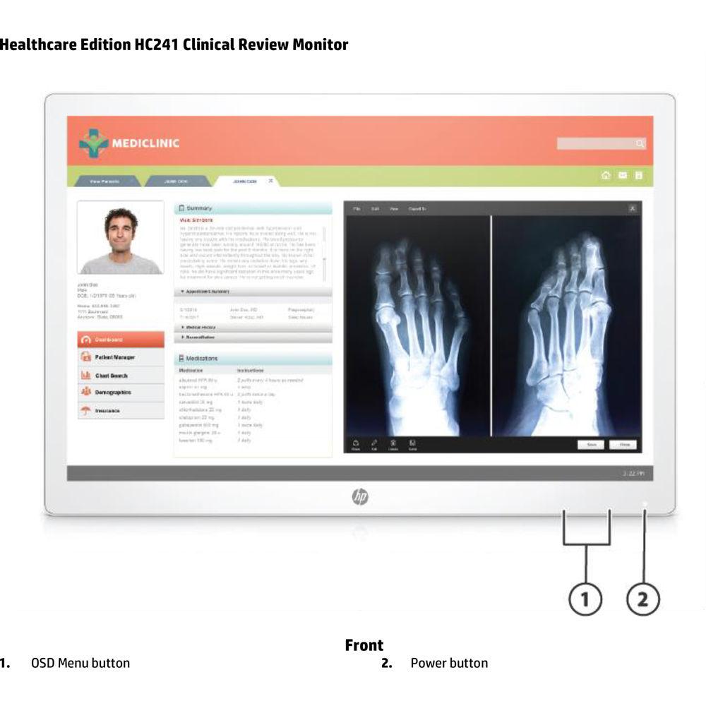 HP 24" HC241P WUXGA LED-LCD Clinical Review Monitor