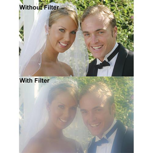 Hoya 62mm Fog Filter Set